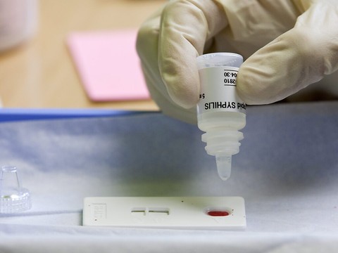 Un antibiotique après un rapport sexuel réduit le risque de MST