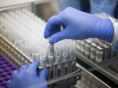 Roche lance un test pour détecter le nouveau variant BA.2.75