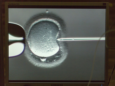 Augmentation du nombre de fécondations in vitro