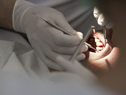 Valais: vers des aides financières ciblées pour les soins dentaires