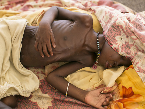 Vers une explosion de la malnutrition aiguë au Soudan