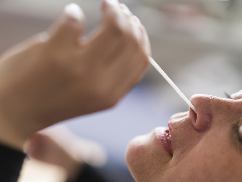 Roche pâtit de la comparaison avec la période Covid