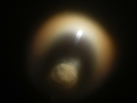 Un 