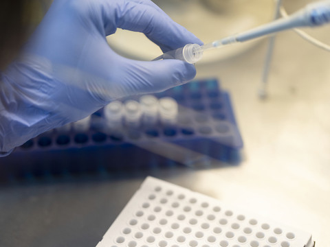 Bristol Myers Squibb acquiert Mirati pour 4,8 milliards de dollars