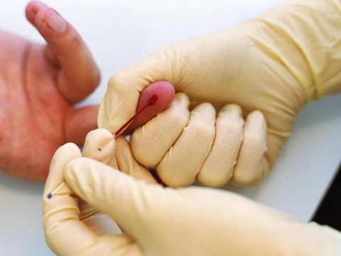 Les coûts de la santé en hausse d'un milliard au premier semestre