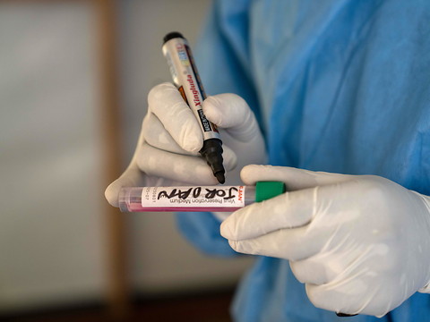 L'Unicef a lancé un appel d'offres pour obtenir des vaccins