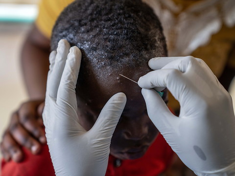 Afrique: 866 décès de la variole du singe depuis le début 2024