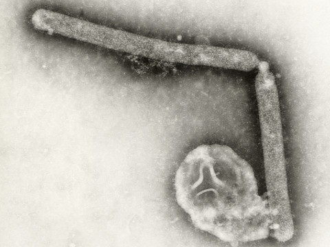 Le virus de la grippe aviaire a muté dans l'organisme d'un patient