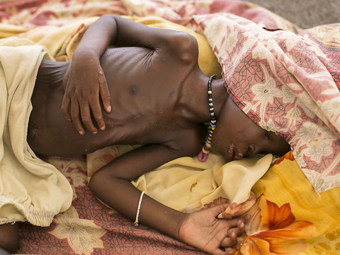 Soudan: 3,2 millions d'enfants risquent de souffrir de malnutrition