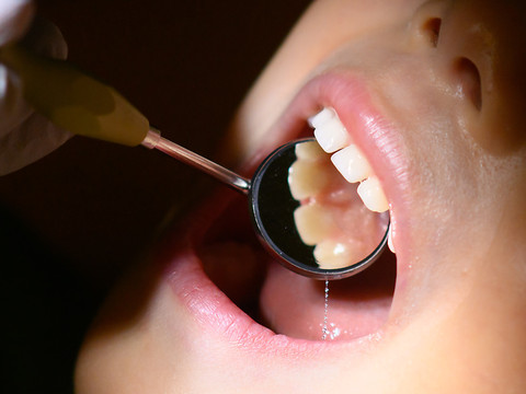 Les Helvètes ont de bien meilleures dents qu'il y a 20 ans