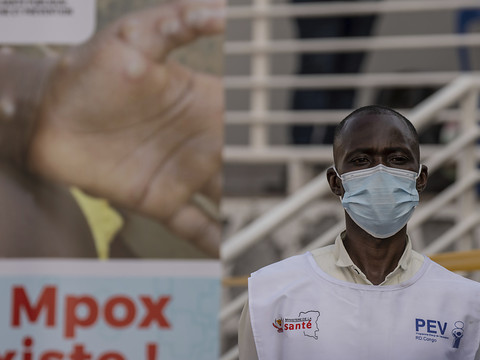 Première détection du nouveau variant de mpox en Suisse