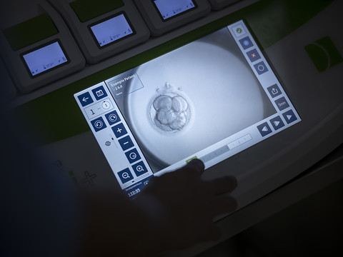 Moins de jumeaux suite à des fécondations in vitro