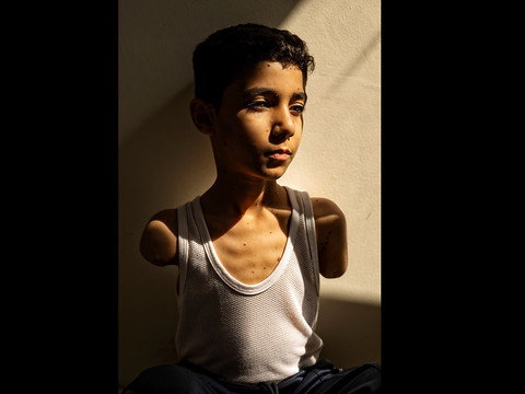 Portrait d'un enfant palestinien amputé primé au World Press Photo