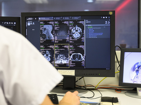 Le CDF veut plus de transparence dans l'imagerie médicale