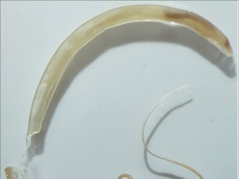 Un nouveau ver parasite officiellement déposé dans un musée bâlois