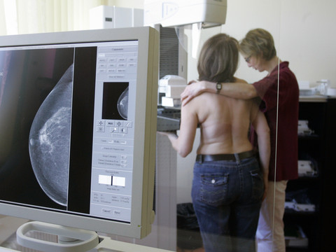Roche revendique un succès clinique contre le cancer du sein