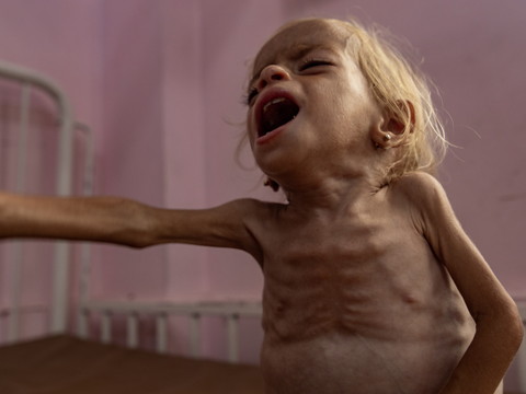 Gaza: près d'un enfant sur six gravement malnutri, estime une étude