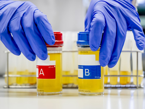 Au LAD d'Epalinges, plongée au coeur de l'analyse du dopage