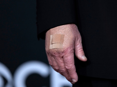 Trump arbore à nouveau un pansement: poignées de main pointées