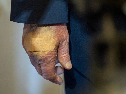 L'ecchymose à la main de Trump due à un choc contre une table