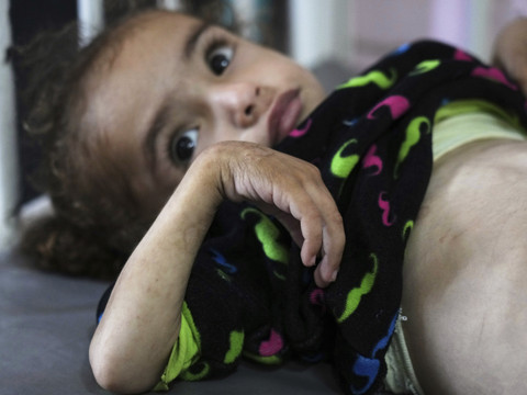 MSF alerte sur des niveaux de malnutrition dans ses hôpitaux à Gaza