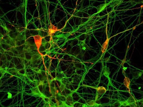 De minuscules blocs de cerveau créés en laboratoires