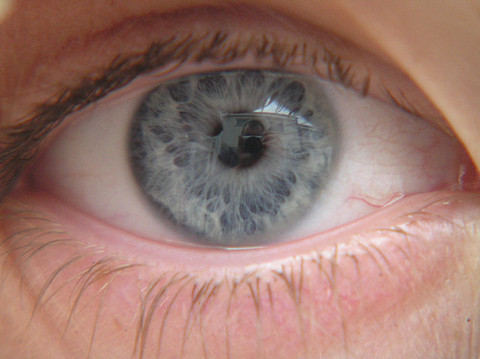 La Clinique des Tilleuls a procédé à 3000 opérations de l'oeil en 2011.
