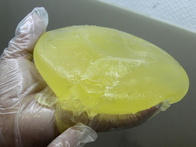 Implants mammaires: certificateur allemand innocenté