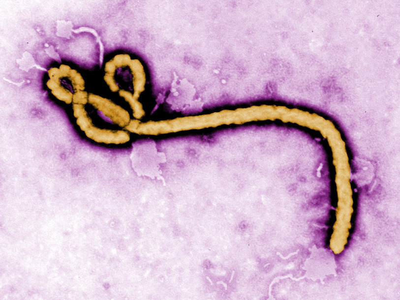 Le virus pourrait persister dans le sperme d'anciens malades