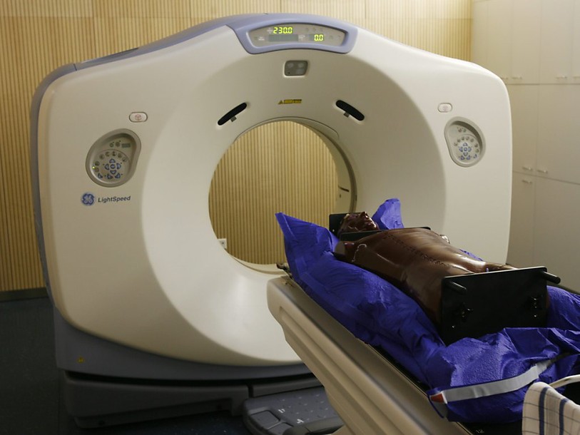 Les risques de cancers devraient être mieux appréhendés en Suisse