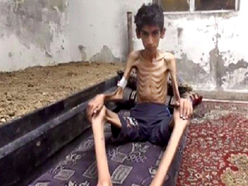 Syrie: plus de 50% des personnes bloquées à Madaya sont des enfants
