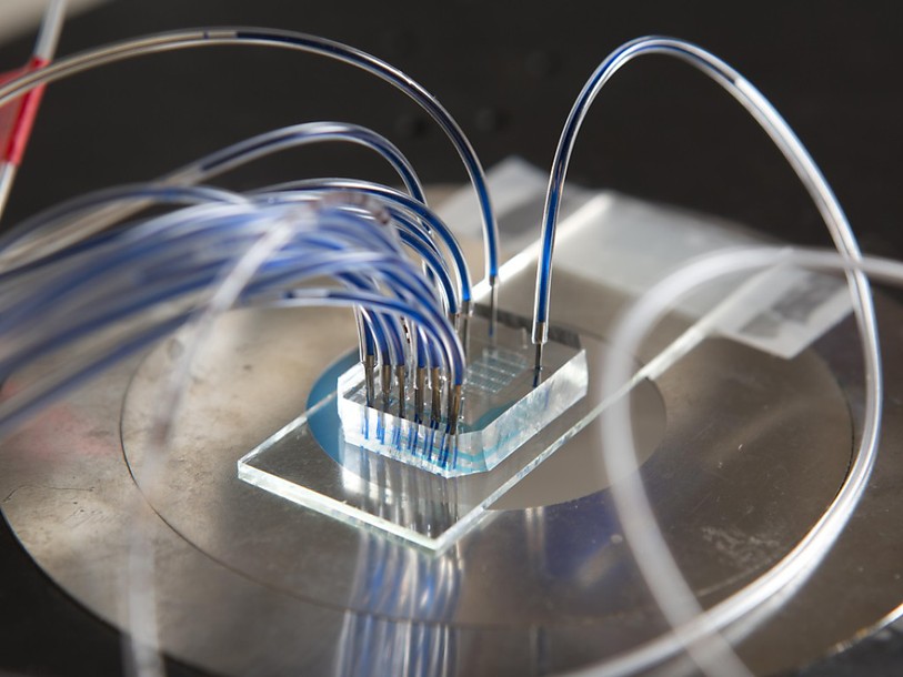 Un outil de diagnostic portable ultra-sensible développé à l'EPFL