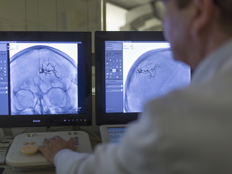 L'agressivité fait vieillir, surtout le cerveau