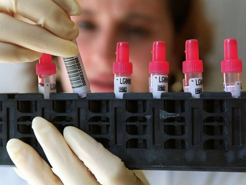 Lugano: 45 patients traités avec des instruments mal désinfectés