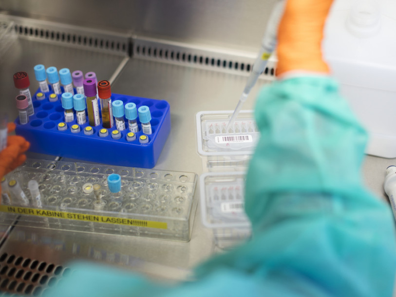 Des résultats encourageants pour un vaccin curatif contre le sida