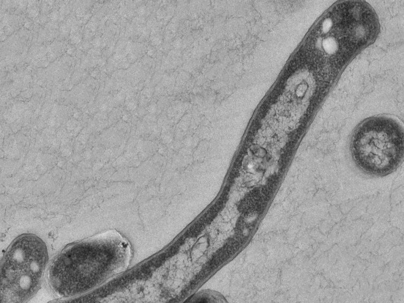 Le plus ancien cas de tuberculose de Suisse a été détecté