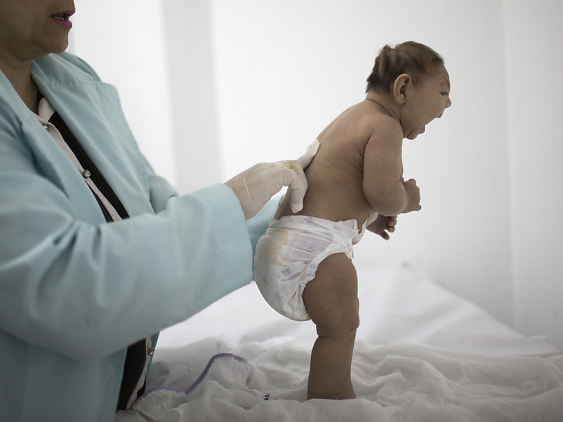 Le lien entre Zika et la microcéphalie du foetus confirmé