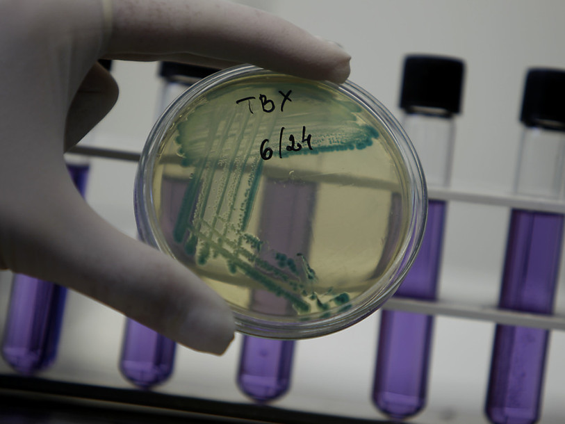 Résistance aux antibiotiques: un mort toutes les 3 secondes en 2050
