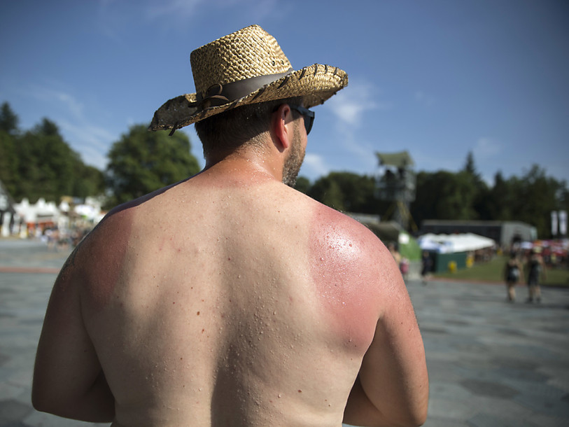 Genève: comment les plantes se protègent des coups de soleil