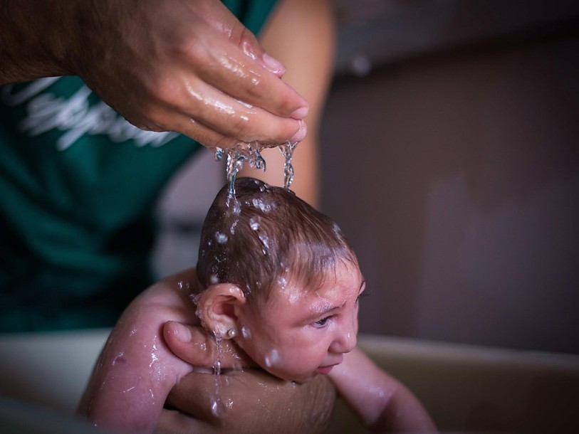 Zika: des milliers de bébés pourraient avoir des microcéphalies