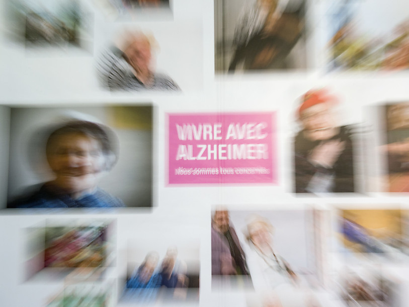 Zurich: nouveau traitement aux anticorps contre l'Alzheimer