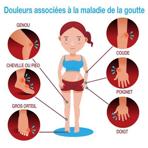 La goutte