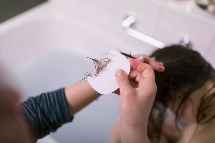 Le peigne fin anti-poux dans des cheveux mouillés, passage régulier obligatoire pour qui souhaite se débarrasser de ses poux. (Photo : Keystone/Gaetan Bally)