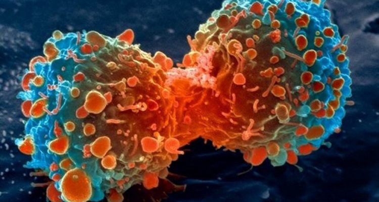Cellule cancer
