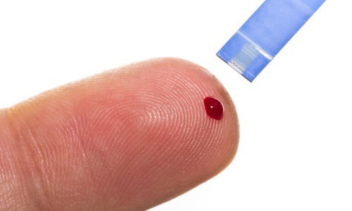 dépistage, hiv