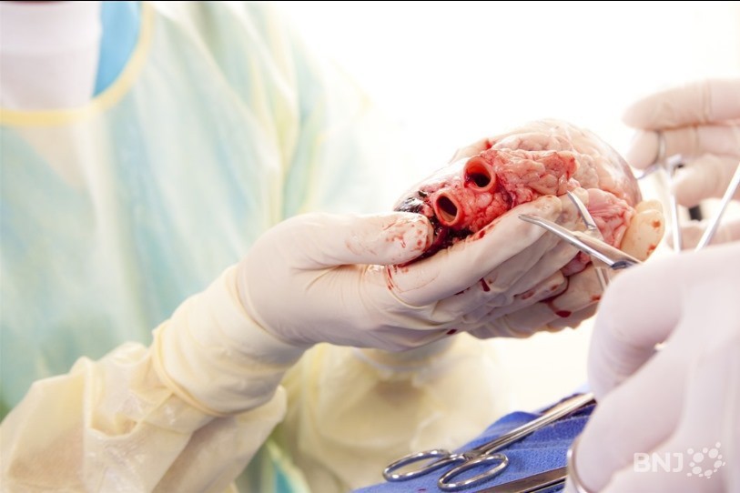 Plus de 1400 personnes étaient en attente d'une transplantation à la fin du mois de septembre. (Photo: illustration)