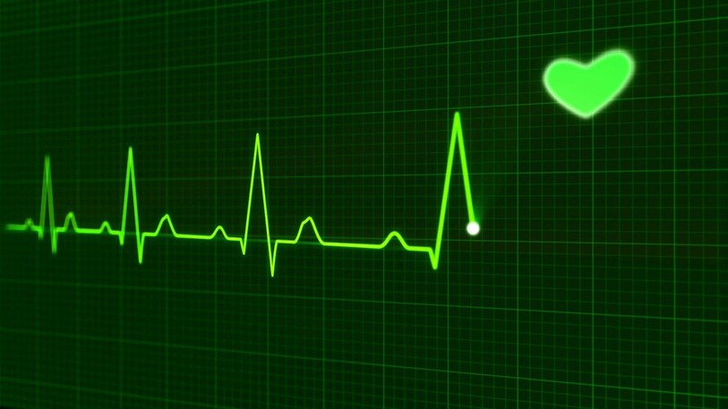 Electrocardiogramme