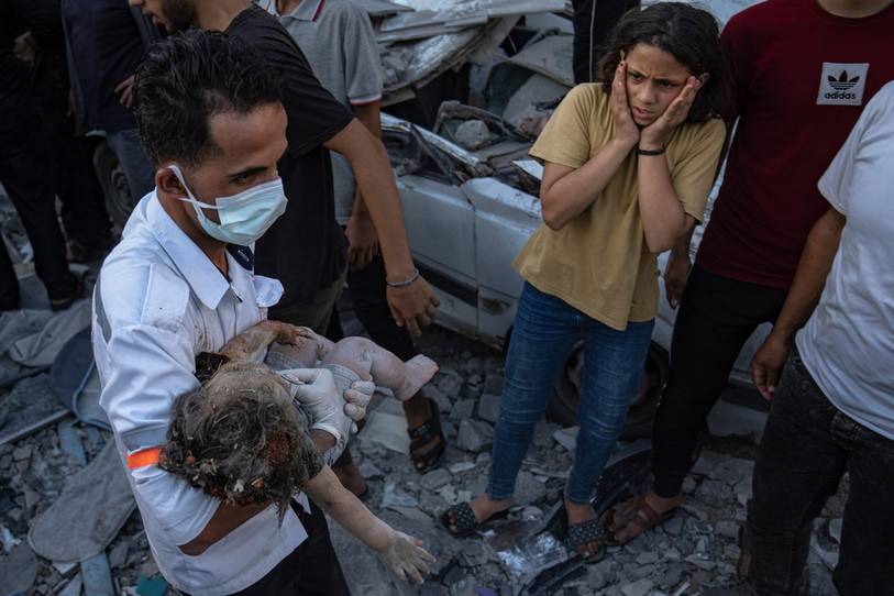 L’Hôpital du Jura, à Delémont, participera à l’accueil et aux soins des enfants blessés de Gaza dans le cadre d’une opération humanitaire coordonnée par la Confédération. (Photo : AP Photo/Fatima Shbair.)