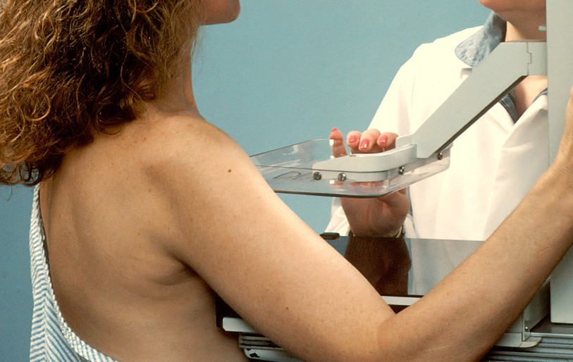 Les mammographies de dépistage continueront d'exister en Suisse (photo libre de droit).