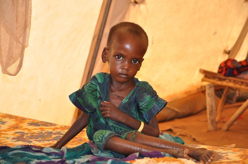 Un enfant malnutri dans une tente de Médecins sans Frontières, en Ethiopie.